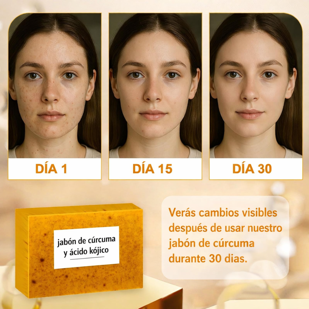 Oferta  limitada Solo por Hoy, 2 unidades Jabón de Cúrcuma & Ácido Kójico, Envió gratis